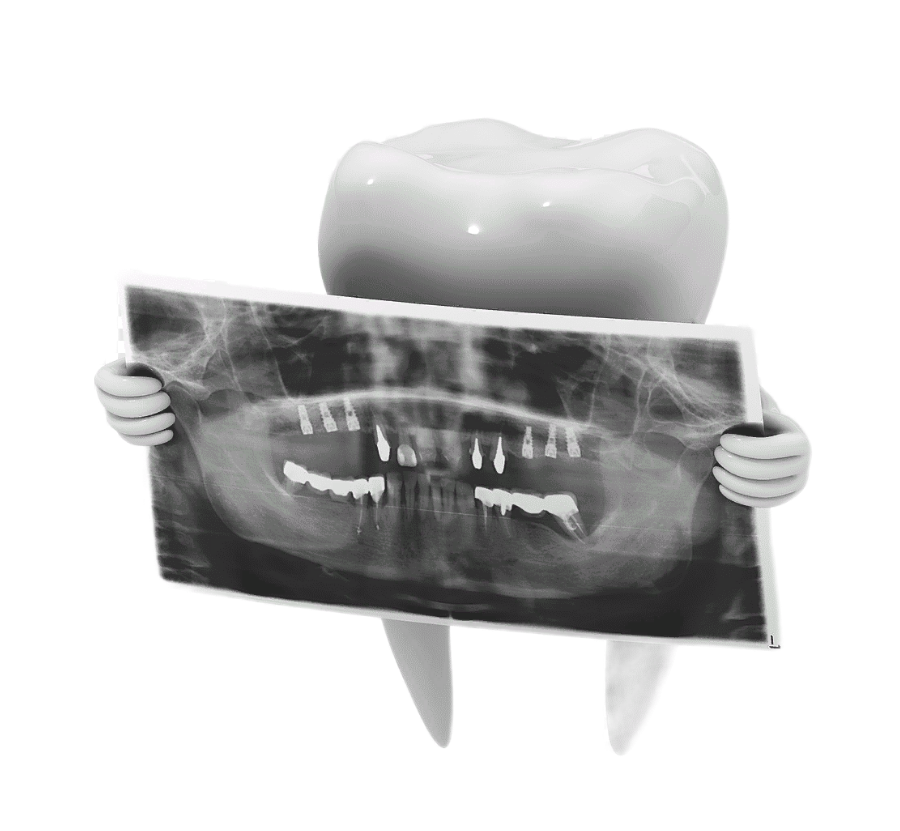 Рентген зубов Воронеж